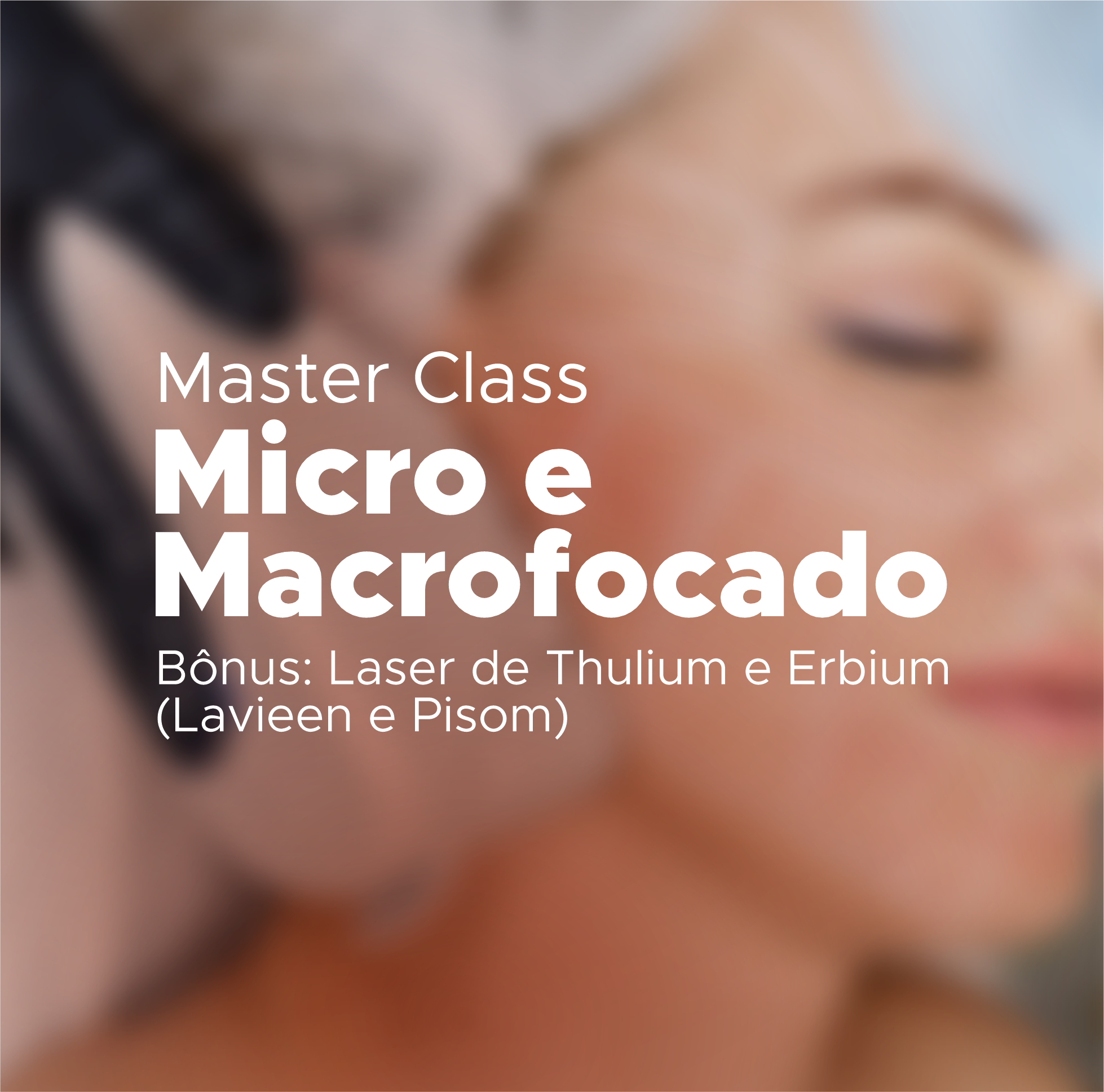 Master Class em Micro e Macrofocado com Bônus: Laser de Thulium e Erbium (Lavieen e Pisom)